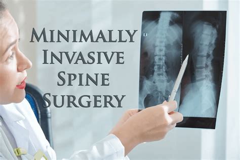 Minimally Invasive Spine Surgery