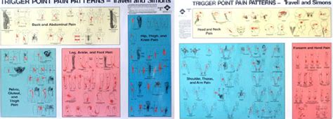 Healing Your Body: Trigger Point Map