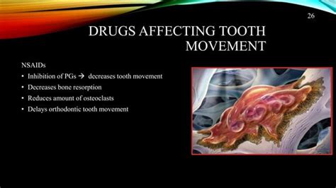 Effects Of Drugs On Orthodontic Treatment Ppt