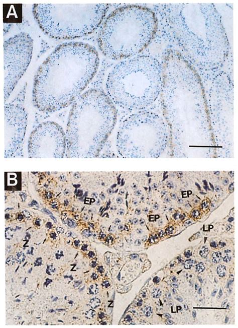 Immunohistochemical Staining With Mab Bc7 In Testicular Cross Sections