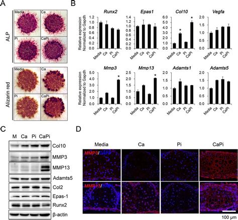 Ca And Pi Mediated Production Of Mmp And Mmp In Hypertrophic