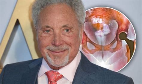 Tom Jones Health Why The Voice Coach Had Hip Replacement Surgery Uk