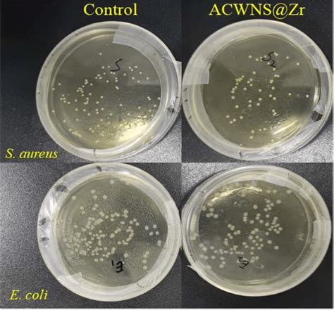 Pictures Depicting The Viable Cells Of S Aureus And E Coli In Agar