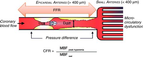 Conceptual Schematic Of Coronary Flow Reserve CFR Measurements CFR