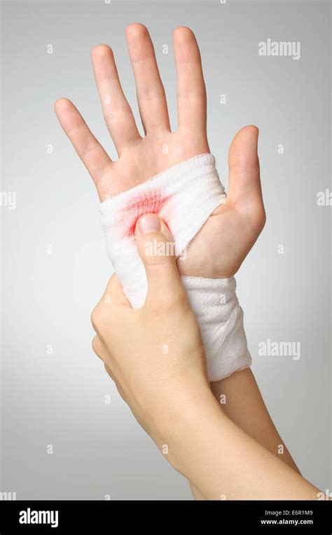 Injured Hand With Bloody White Gauze Bandage Stock Photo Alamy