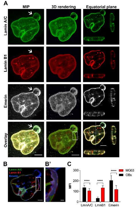 Behaviour Of Lamins And Emerin And Nuclear Morphology In Mg63 Cell