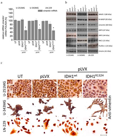 Effect Of Idh Wt Or Idh R H On The Expression Of Actin Influencing