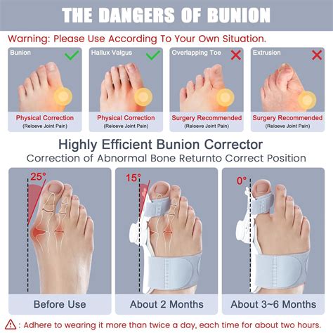 Bunion Corrector Adjustable Knob Double Correction Separator For Big