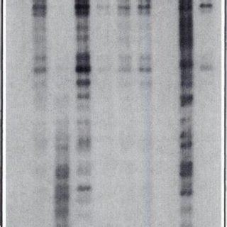 Topoisomerase Il Mediated DNA Cleavage Induced By F3 Lapachoneis Due To