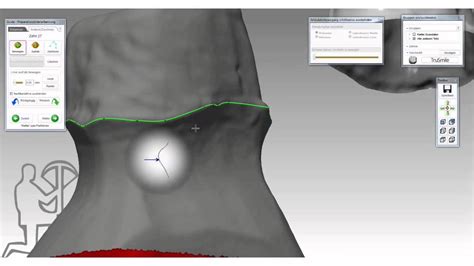 Dentaltechnik CAD CAM Teaser Model Von Antagonistischen OK Und UK