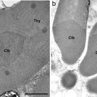 Unique plastids traits in glaucophyte plastids. Transmission electron ...