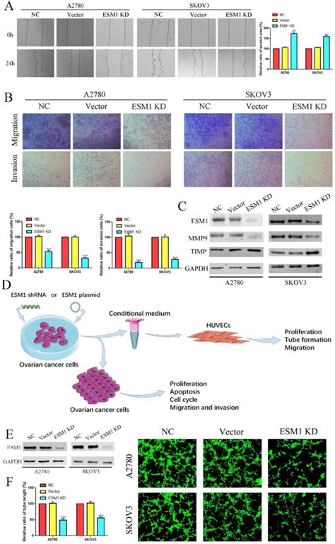 ESM1 KD Impedes OC Migration Invasion And Angiogenesis The Migration