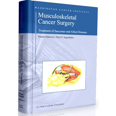 Musculoskeletal Cancer Surgery Treatment Of Sarcomas And Allied