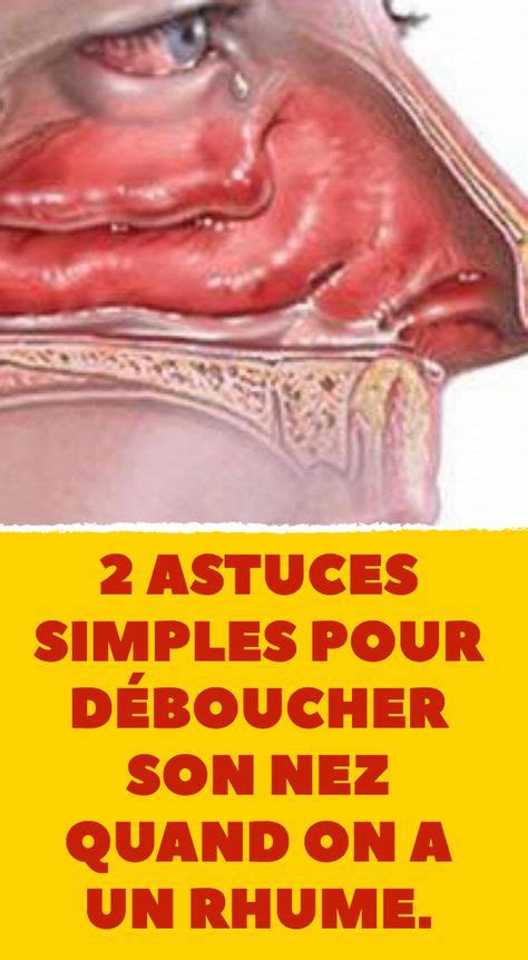 Astuces Simples Pour D Boucher Son Nez Quand On A Un Rhume Sante