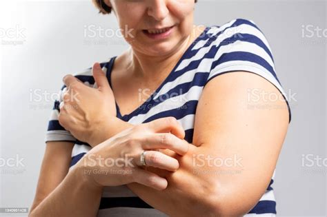 Woman Scratching Arm Indoors Space For Text Allergy Symptoms People