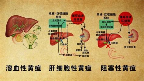 肝功能指标怎么看？医生手把手教你看懂化验单肝脏