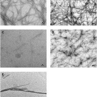 Observations By Transmission Electron Microscopy Tem Of The