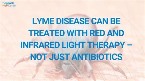 Lyme Disease Can Be Treated With Red And Infrared Light Therapy Not