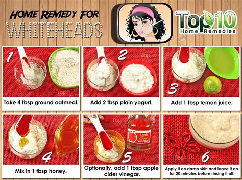 Home Remedies For Whiteheads Top 10 Home Remedies