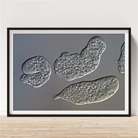 Entamoeba Histolytica Protozoa 1 Poster By Science Photo Library Science Photo Gallery