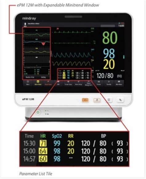 Mindray Epm 10 Monitor