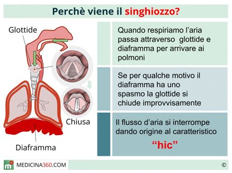 Singhiozzo Cause Rimedi E Terapie Mediche Per Quello Cronico