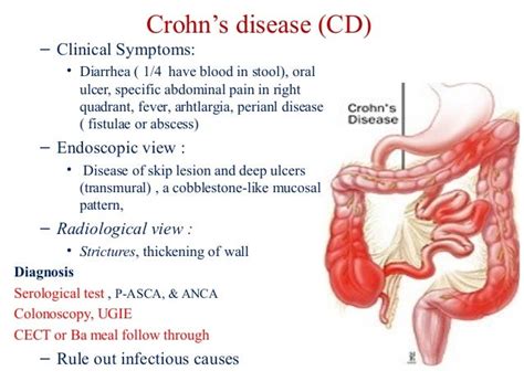 Digestive system and its disease