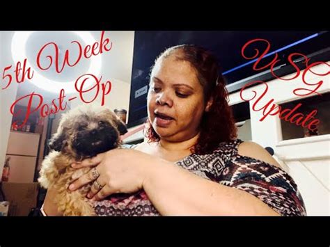 5th Week Post Op Update VSG Gastric Bypass Gastric Sleeve VSG