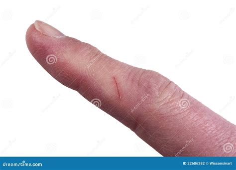 Finger With Cut, Risk Of Infection, Isolated Stock Photo - Image of ...