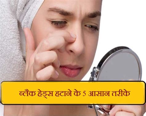 Skin Care Tips नाक पर झाई मार रहे काले दाने क्रीम पाउडर से नहीं इन 5 तरीकों से होंगे ठीक 5