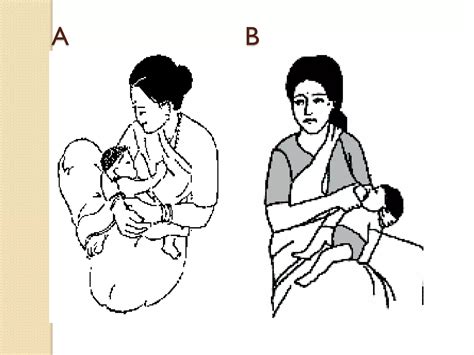 Puerperium Meaning In Hindi 1