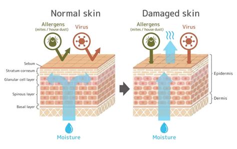 Recognizing The Signs Of A Damaged Skin Barrier Wildling