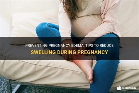 Preventing Pregnancy Edema: Tips To Reduce Swelling During Pregnancy | ShunChild