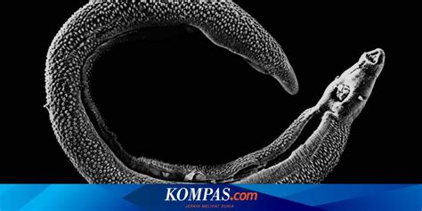 Penyakit Schistosomiasis Gejala Penyebab Pengobatan Kompas