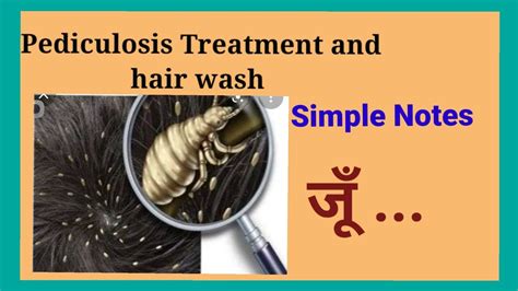 Simple Or Easy Notes Of Pediculosis Treatment Or Hair Wash For Nursing