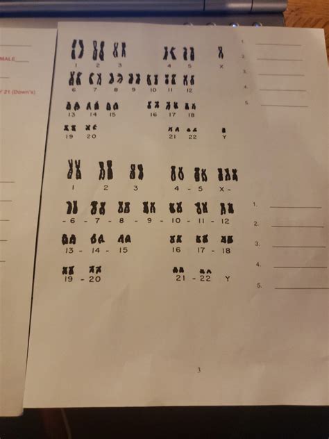 Solved Name Karyotype Analysis Examine And Interpret The Chegg