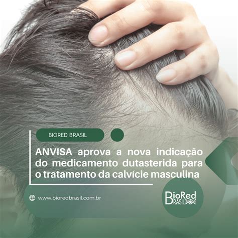 Anvisa Aprova A Nova Indica O Do Medicamento Dutasterida Para O