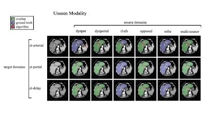 Radiology Artificial Intelligence On Twitter Systematic Analysis Of