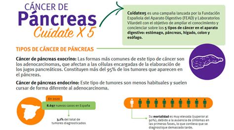 Cáncer De Páncreas E Insuficiencia Exocrina Saludigestivo