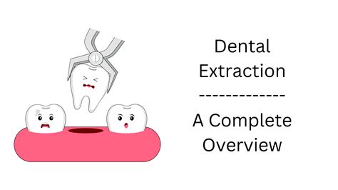 Dental Extraction – A Complete Overview