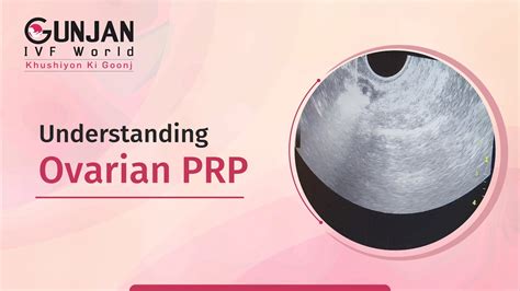 Understanding Ovarian Prp Youtube