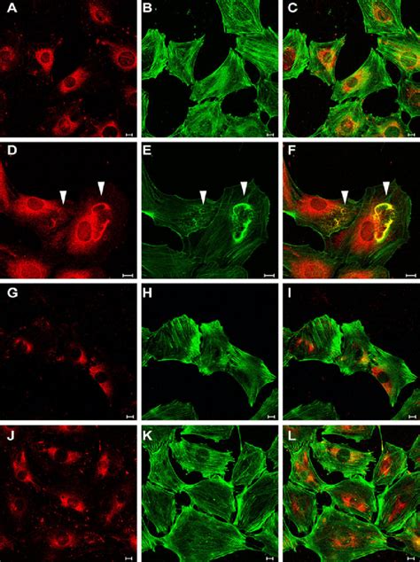 Inhibition Of Cpla A Enzymatic Activity With Pyrrolidine Or Wyeth