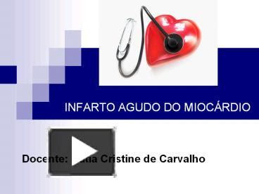 Ppt Infarto Agudo Do Mioc Powerpoint Presentation Free To View Id