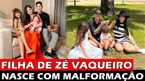 Filho De Z Vaqueiro Nasce Malforma O Cong Nita E Est Em Uti