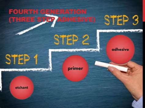 Dentin Bonding Agents Generations Ppt