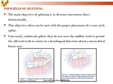 Splinting Part I Certified Fixed Orthodontic Courses By Indian Denta