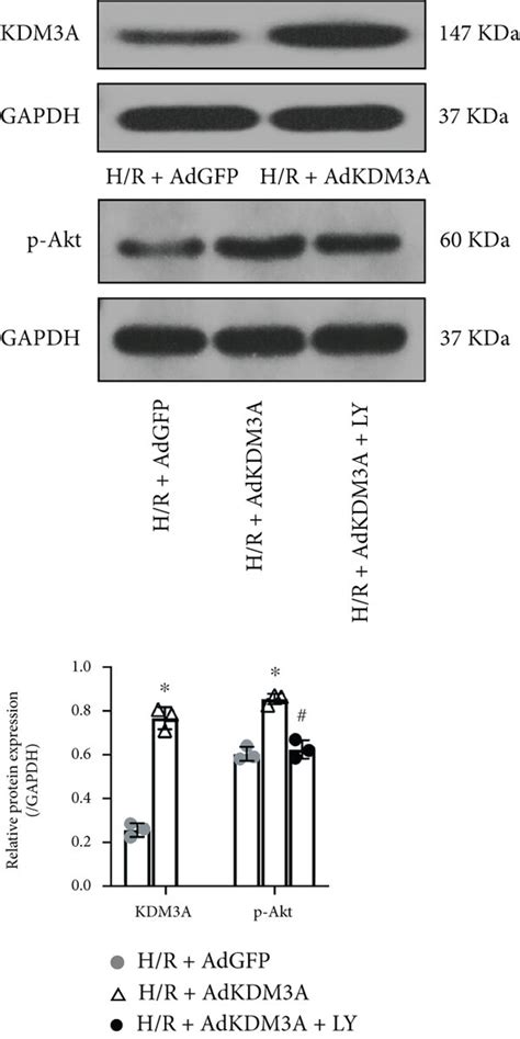 KDM3A Overexpression Mitigated H R Induced CMEC Pyroptosis Through