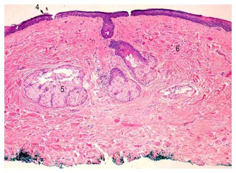 Histological Cross Section Of Ocular Dermoid Download Scientific Diagram