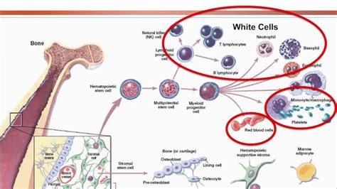 Aplastic Anemia Approach On Diagnosis And Treatment Options 2018 Youtube