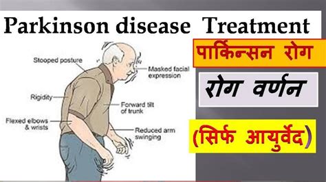 Parkinson S Disease In Hindi Parkinson S Disease Ayurvedic Treatment